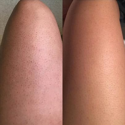 Radiant Glow Sugar Scrub - Natural Exfoliation & Moisturizer, Unveil Your Skin’s Natural Beauty, 8oz