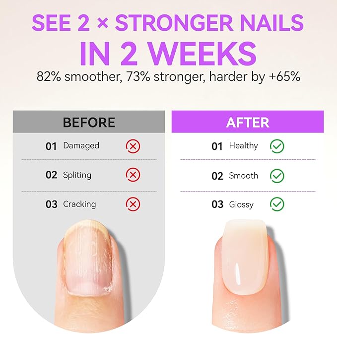 Gelike EC 2-in-1 Nail Rescue Kit: Apricot Nail Ridge Filler & Pineapple Cuticle Oil (15ml) - Tropical Scented Nail Care - Strengthens & Brightens - Travel-Friendly Mini Size