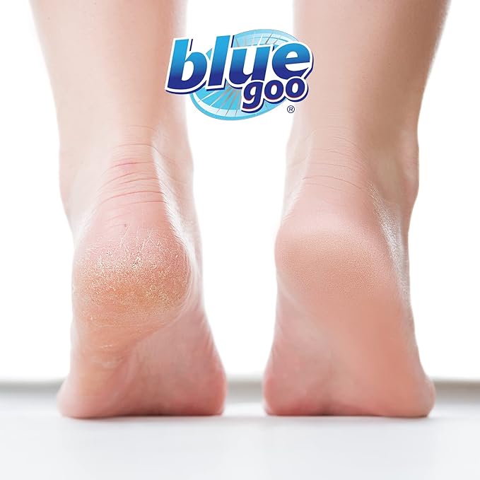 Blue Goo Cracked Heels & Dry Hands Intense Skin Softener - for Calluses, Corns & Elbow Dryness Relief, Fast- Penetrating Hydrating Moisturizer, Made w/ 100% Pure Emu Oil & Beeswax, 2 oz (3 Pack)
