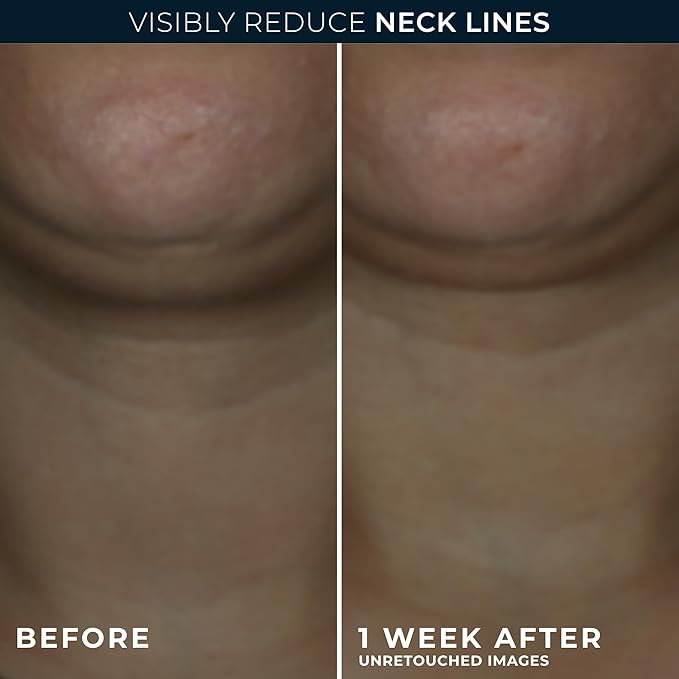 RoC Derm Correxion Neck Cream with Hyaluronic Acid and Advanced Retinol to visibly Tighten & Lift Horizontal Neck Lines, Facial Moisturiser to Contour Face, Neck + Jaw, (1.7 oz) with Retinol Packette