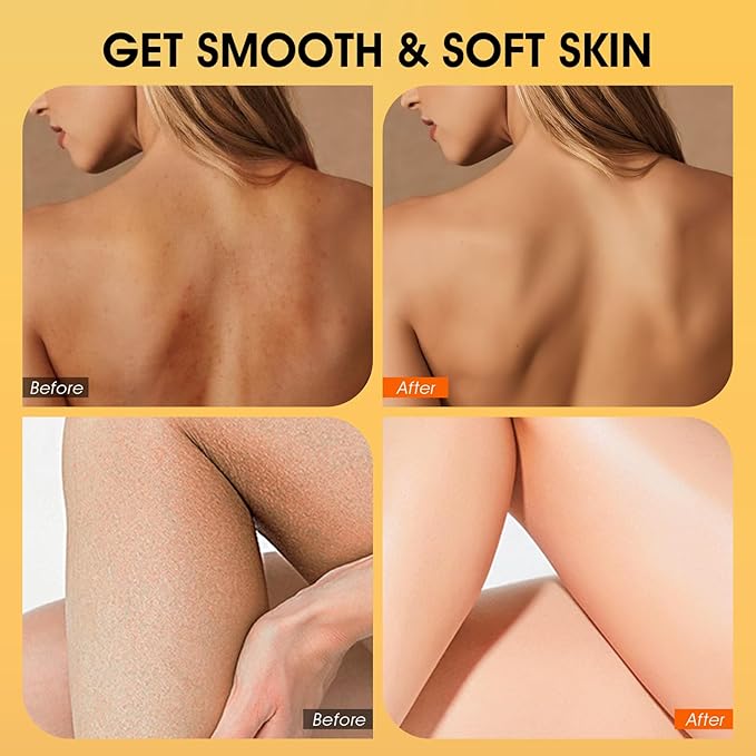 Body Scrub,Turmeric Exfoliating Body Scrub, with Coconut Oil & Vitamin C, Bikini Area Exfoliator Gently Exfoliate Body Hand and Foot Scrub, Moisturized Skin for Women and Men, 11.28oz/320g
