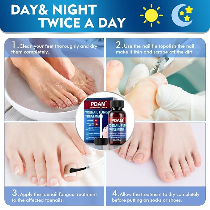 Toenail Fungus Treatment Extra Strength - Toe Nail Fungus Treatments for Thick, Nail Strengthener and Growth, Nail Fungus Treatment Extra Strength for Broken, Discolored Nail & Ingrown Toenail - 30ml
