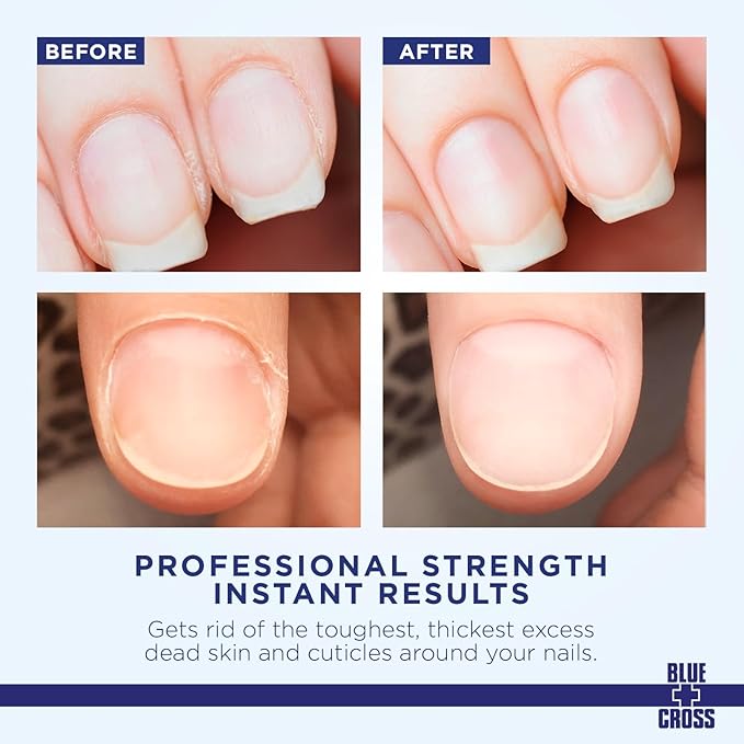 Blue Cross Cuticle Remover Liquid, Cuticle Softener for Nails, Professional Nail Care with Lanolin for Brittle Hang Nails, Hydrating, Moisturizing, Dry Cuticles, Made in USA, 32oz