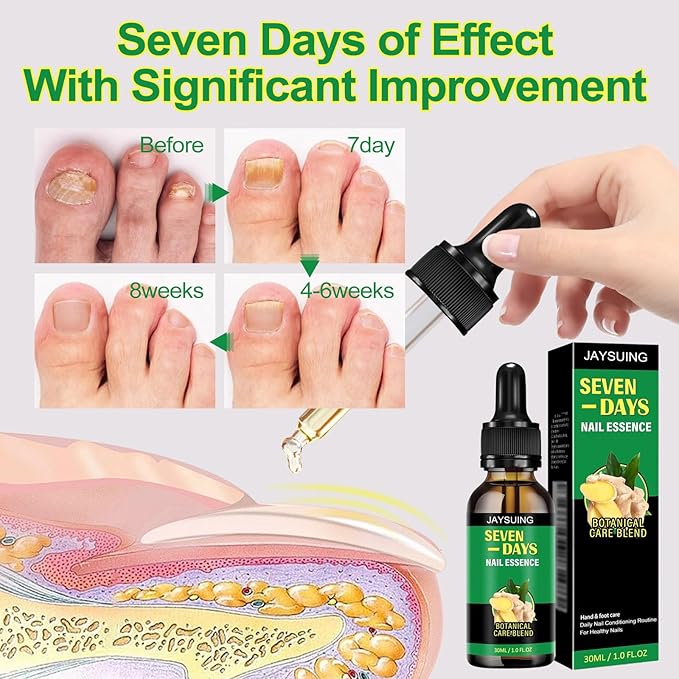 7 Days Nail Treatment,Ginger Nail Drops, Multi-Purpose Nail Repair(2PCS)
