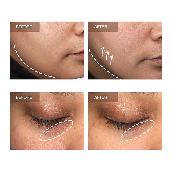 Facial Lifting Spray, features advanced technology to quickly and visibly tighten and smooth skin. It helps reduce fine lines and wrinkles while providing anti-aging benefits (30ml + 3ml)