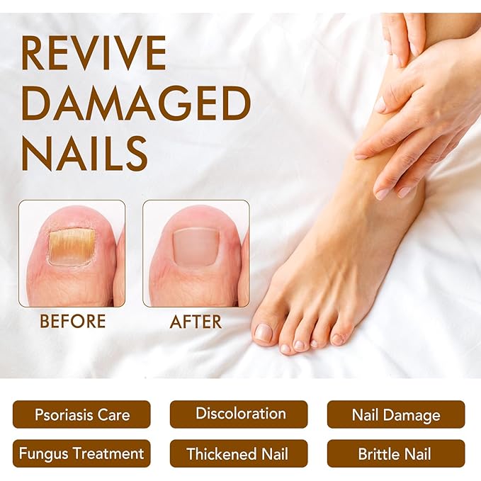 Ginger Nail Growth Strengthener Serum – Ginger-Infused Nail Repair Oil for Care, Natural Nail and Strengthener Solution