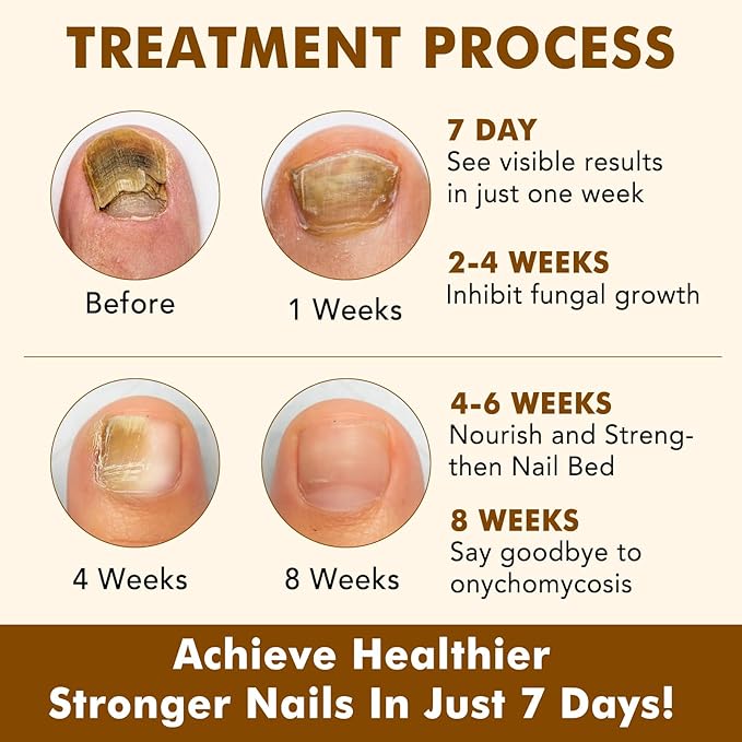 Ginger Nail Growth Strengthener Serum – Ginger-Infused Nail Repair Oil for Care, Natural Nail and Strengthener Solution