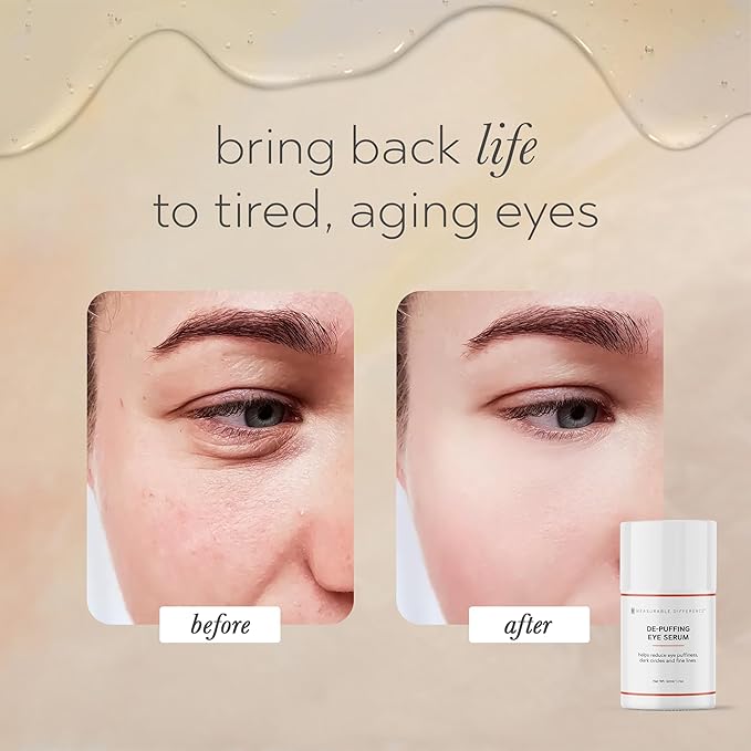 De-Puffing Eye Serum with Caffeine, Aloe Vera, Hyaluronic Acid & Peptides | Reduces Puffiness, Dark Circles, and Fine Lines | Hydrating Under Eye Treatment for All Skin Types
