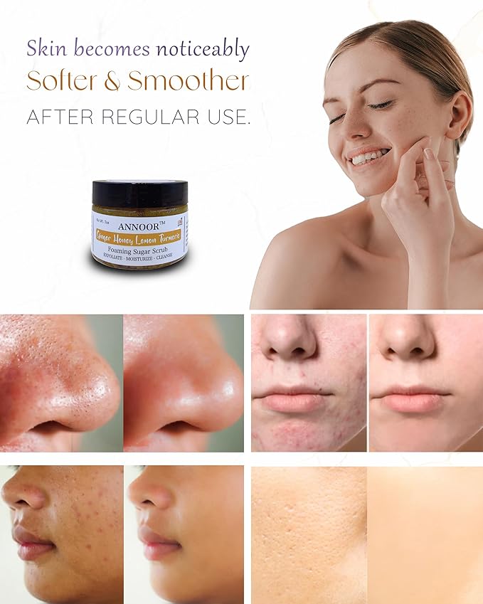 Foaming Sugar Scrub by Annoor - 7 Oz|Ginger, Honey, Lemon, Turmeric |No Parabens, Sulphates, No Harmful Chem |Face and Body Exfoliating