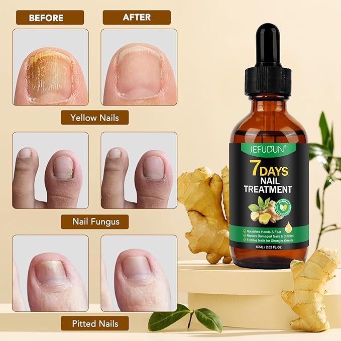 Ginger Nail Strengthener Serum 2pack– Ginger-Infused Nail Repair Oil for Care, Natural Nail and Strengthener Solution