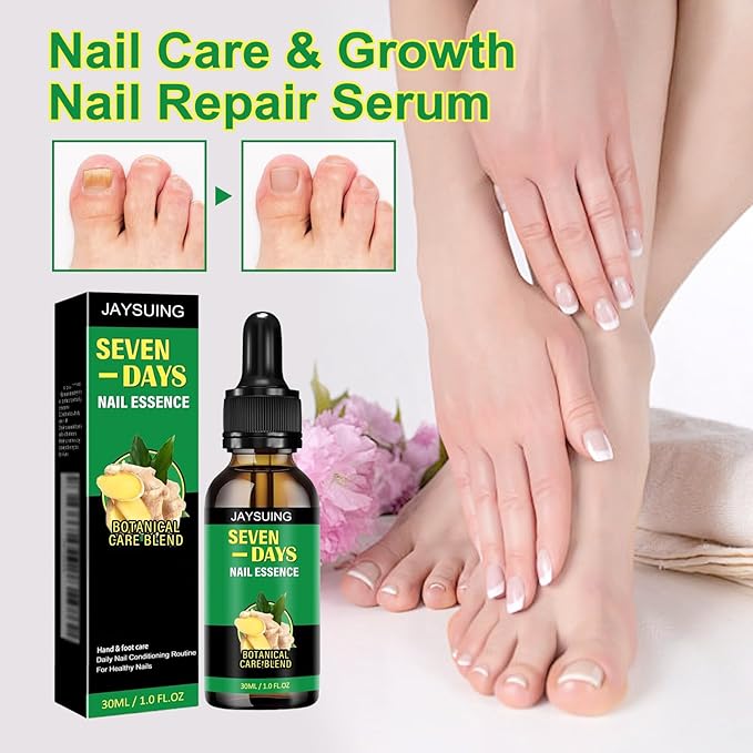 7 Days Nail Treatment,Ginger Nail Drops, Multi-Purpose Nail Repair(2PCS)