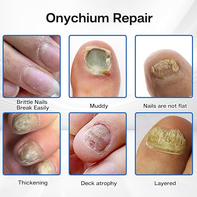 Nail Patches - Toenail Care for Toenail Fingernails - 8-Hour Nightime N ail Renewal - 60