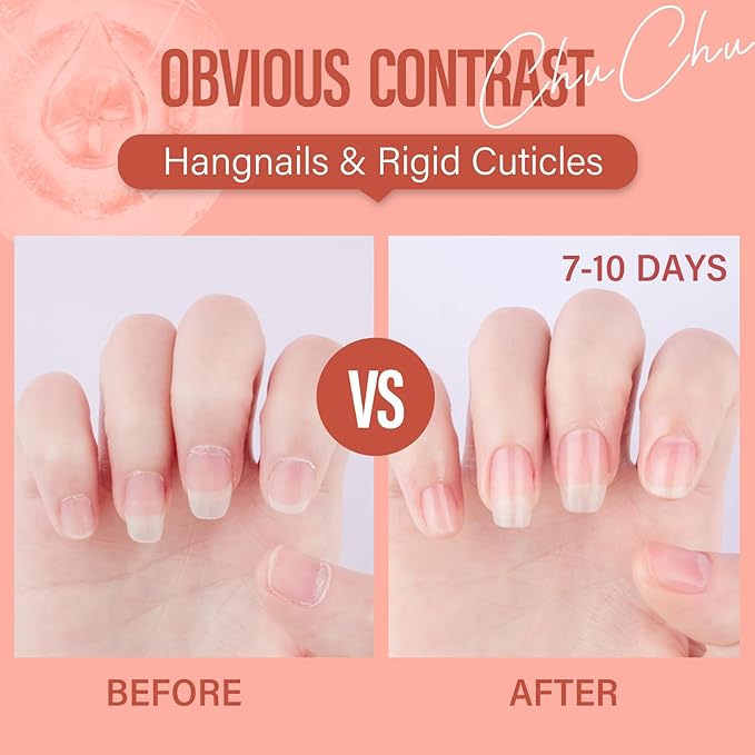 CHUCHU Organic Cuticle Oil for Nails: Pomegranate Jojoba Nail Oil with Vitamin B & E - Moisturizes Repairs and Promotes Nail Growth - Prevents Dryness Hangnails and Chapped Skin 15ML