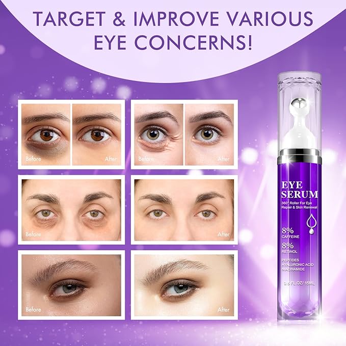 Under Eye Roller Serum|5% Caffeine 5% Retinol Eye Cream for Dark Circles, Puffiness and Bags, Puffy Bags Fine Lines Wrinkles, 360° Massage Ball Cream, 8% Hyaluronic Acid Serum