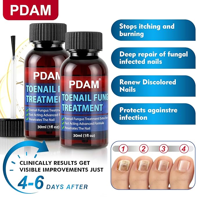 Toenail Fungus Treatment Extra Strength - Toe Nail Fungus Treatments for Thick, Nail Strengthener and Growth, Nail Fungus Treatment Extra Strength for Broken, Discolored Nail & Ingrown Toenail - 60ml