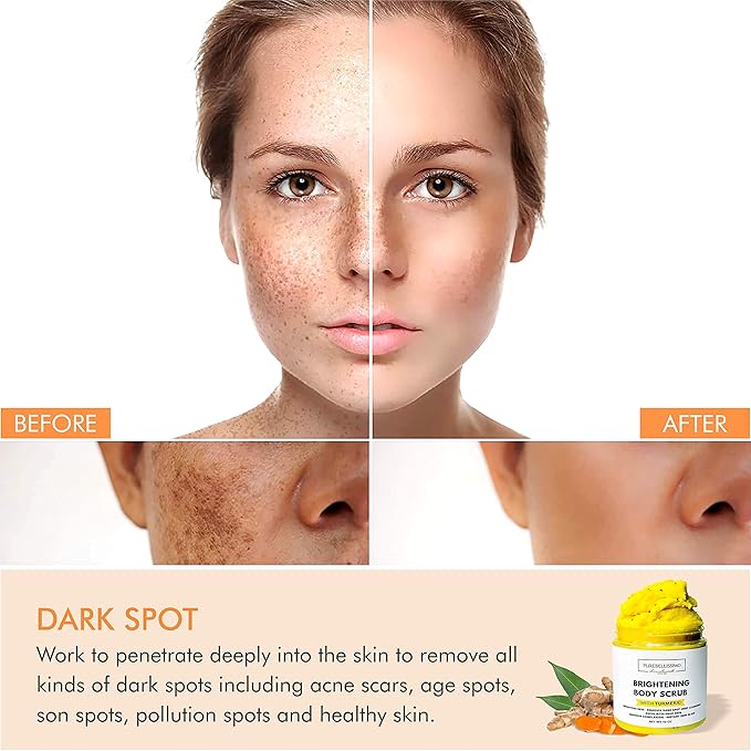 Turmeric Skin Brightening Scrub for Dark Spots, Dark Inner Thighs Bikini Area Underarms, Natural Exfoliating Turmeric Face Scrub ALL NATURAL 10OZ