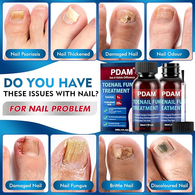 Toenail Fungus Treatment Extra Strength - Toe Nail Fungus Treatments for Thick, Nail Strengthener and Growth, Nail Fungus Treatment Extra Strength for Broken, Discolored Nail & Ingrown Toenail - 60ml