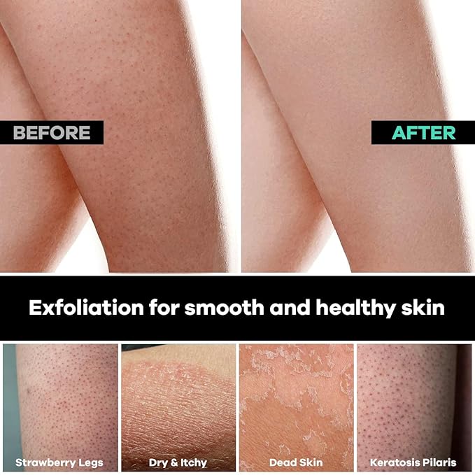 Dermasuri Deep Exfoliating Body Mitt & Back Scrub Bundle - Bath & Shower Body Scrubs, Cleansing & Full Body Exfoliation, Spa Exfoliator Glove, Dry Skin Remover, Skin Care Treatment for Women & Men