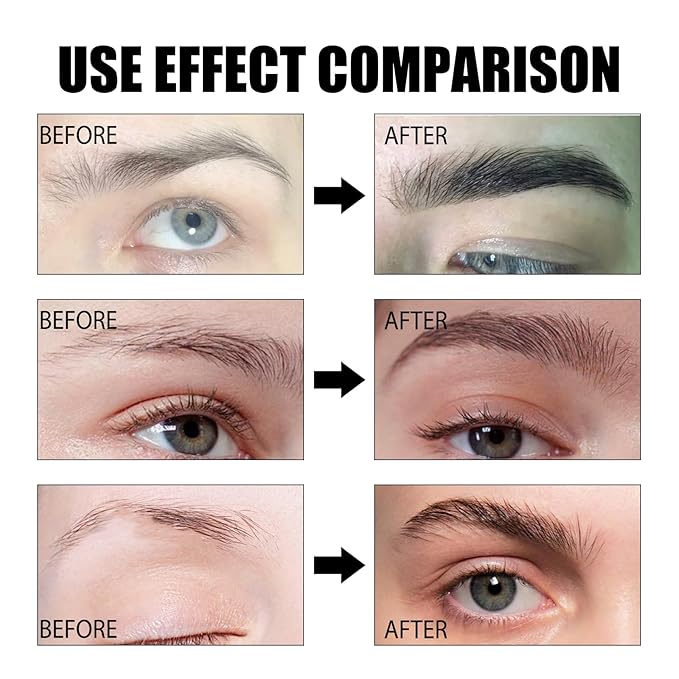 Eyebrow Growth Serum, Rapid Eyebrow Serum Lash Brow Nourish Serum, Natural Thick, Lengthen, Repair Thick Eyebrows Nutrient Solution, for Stronger, Bolder Thicker Fuller Eye Brows, Vegan