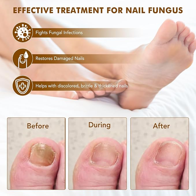 Ginger Nail Growth Strengthener Serum – Ginger-Infused Nail Repair Oil for Care, Natural Nail and Strengthener Solution