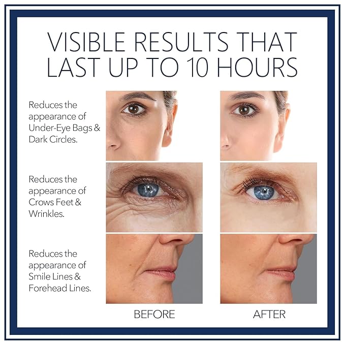 Rapid Reduction Eye Serum - Visibly Reduces Under-Eye Bags, Wrinkles, Dark Circles, Fine Lines & Crow's Feet Instantly, Anti Aging Wrinkle Remover for Face-10ML
