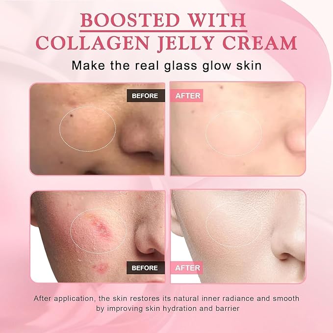 Collagen Jelly Cream - Niacinamide & Freeze-Dried Hydrolyzed Collagen - Improves Elasticity & Hydration, Reduce Fine Lines & Dullness, Gives 24h Glow Korean Skin Care For All Skin Types (3.38 fl.oz)