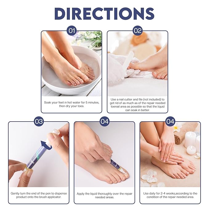 Toenail Treatment -Extra Strength Nail Treatment - Nail Repair Pen for Nail Discoloration Nails - 4PCS
