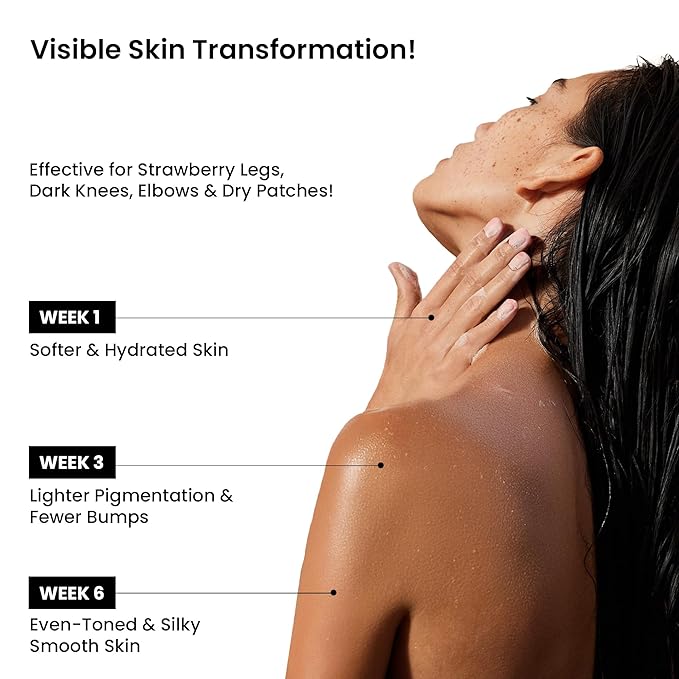 WildOak Vitamin C Shea Butter Sugar Body Scrub | With Collagen & Peptides | Tan Removal | Lightens Dark Area Like Neck & Elbows | Smoothen Bumpy Legs & Hands | Hydrating & Exfoliating Scrub | 10.58 oz