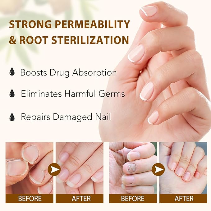 Ginger Nail Strengthener Serum 2pack– Ginger-Infused Nail Repair Oil for Care, Natural Nail and Strengthener Solution