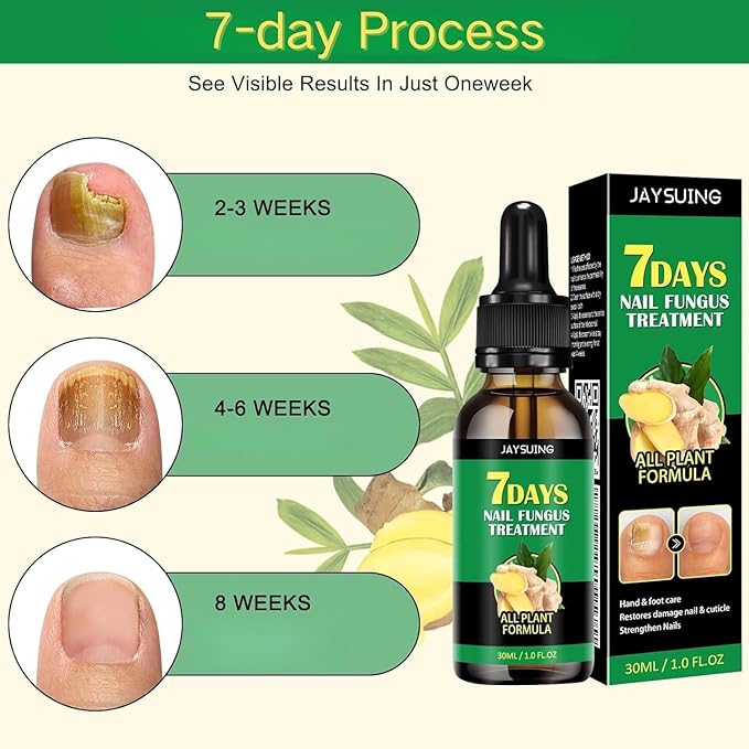3PCS Ginger Nail Care Serum - Moisturize the Cuticle & Strengthen Nails and Helps Nails Healthy Grow