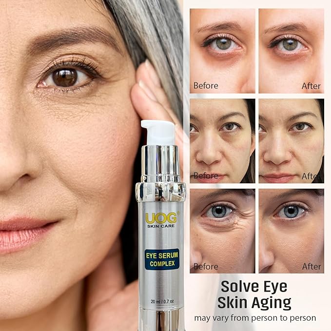 UOG Eye Serum Complex – Rapid Reduction Eye Serum for Dark Circles, Puffiness, Wrinkles & Crow’s Feet | Anti-Aging Formula for Firm, Youthful Eyes | Hydrates & Smooths (20ml / 0.7oz)