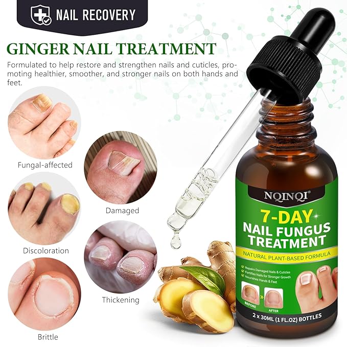 7 Days Nail Fungus Treatment, Fungi Nail Liquid Maximum Strength, Ginger Cuticle Care Oil for Strengthen & Promote Nail Growth (2PCS)