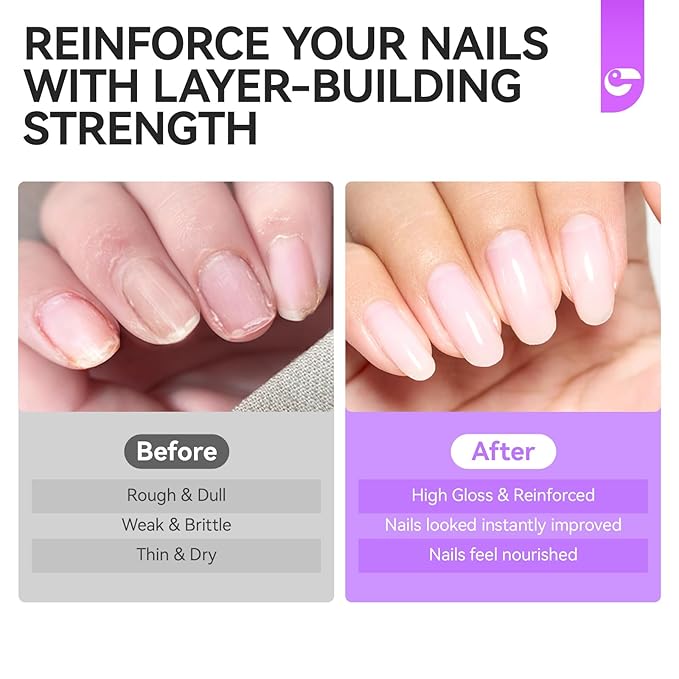 Gelike EC Ridge Filler Nail Strengthener: Milky White Extra Strong Nail Hardener for Damaged Nails & Growth Treatment for splitting nails - Organic, Vegan, Cruelty Free for Daily Home Salon