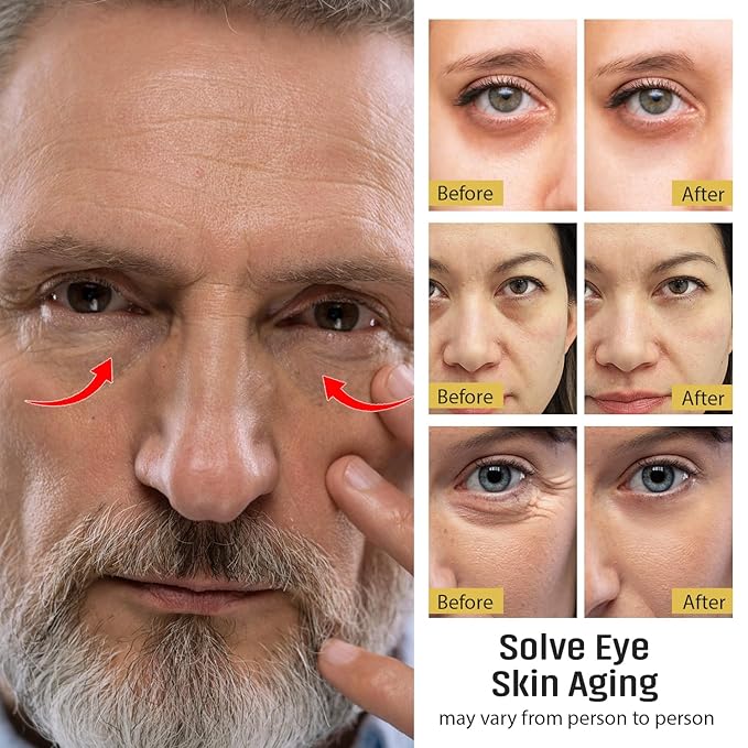 UOG Eye Serum Complex – Rapid Reduction Eye Serum for Dark Circles, Puffiness, Wrinkles & Crow’s Feet | Anti-Aging Formula for Firm, Youthful Eyes | Hydrates & Smooths (20ml / 0.7oz)