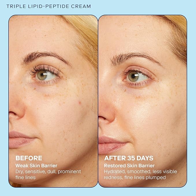 Skinfix Triple Lipid-Peptide Cream - 1.7 oz - Rich Face Moisturizer to Instantly Hydrate & Restore Dry, Sensitive Skin - Non-Comedogenic, Fragrance Free, Vegan, Cruelty Free
