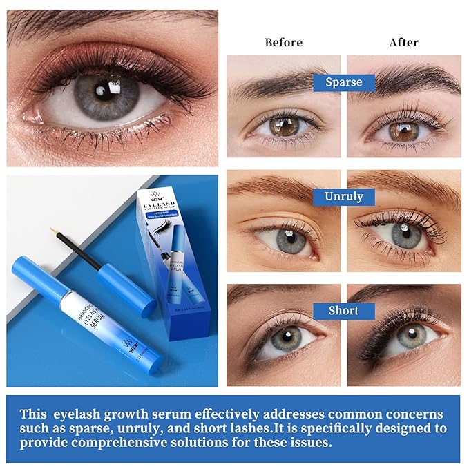 QIC Lash Serum - 4ml Eyelash Enhancing Serum, W3W Eyelash Serum for Eyelash Thicker, Stronger, Longer Suitable for Lashes & Brows