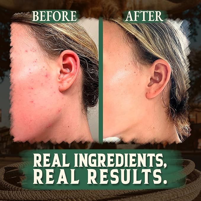 Wrath & Remedy Handmade Whipped Organic Beef Tallow for Skin - 4 OZ (Eucalyptus) — Grass Fed Beef Tallow Moisturizer and Honey Balm for Silky, Sensitive-Skin, Eczema, Rosacea - Free of Harsh Chemicals