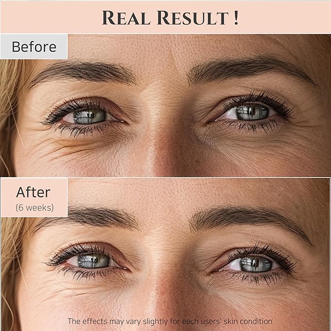 Beauty of Joseon Revive Eye Serum with Retinal Niacinamide Correction for Puffy Eye Bags Fine Lines Dark Circles Wrinkles, Korean Skin Care 30ml, 1 fl.oz, 2 Packs